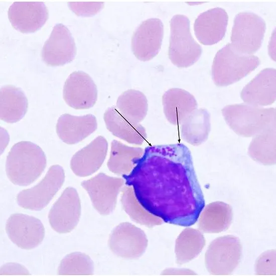 Human Monocytic Ehrlichiosis